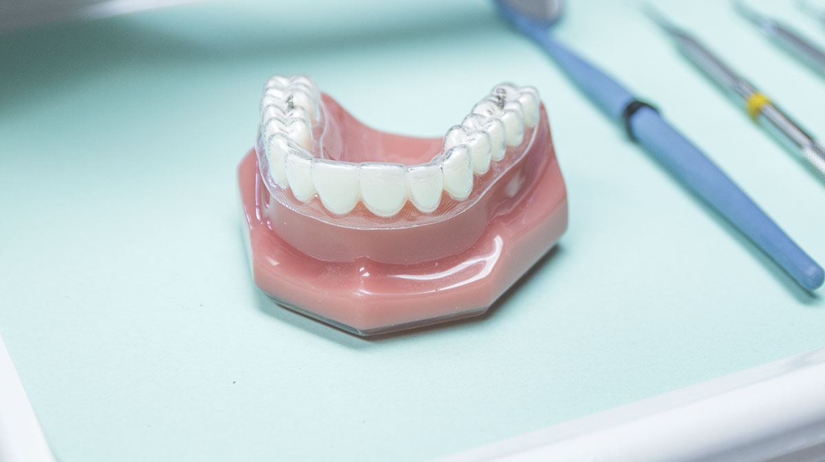Clear dental aligner on a teeth model