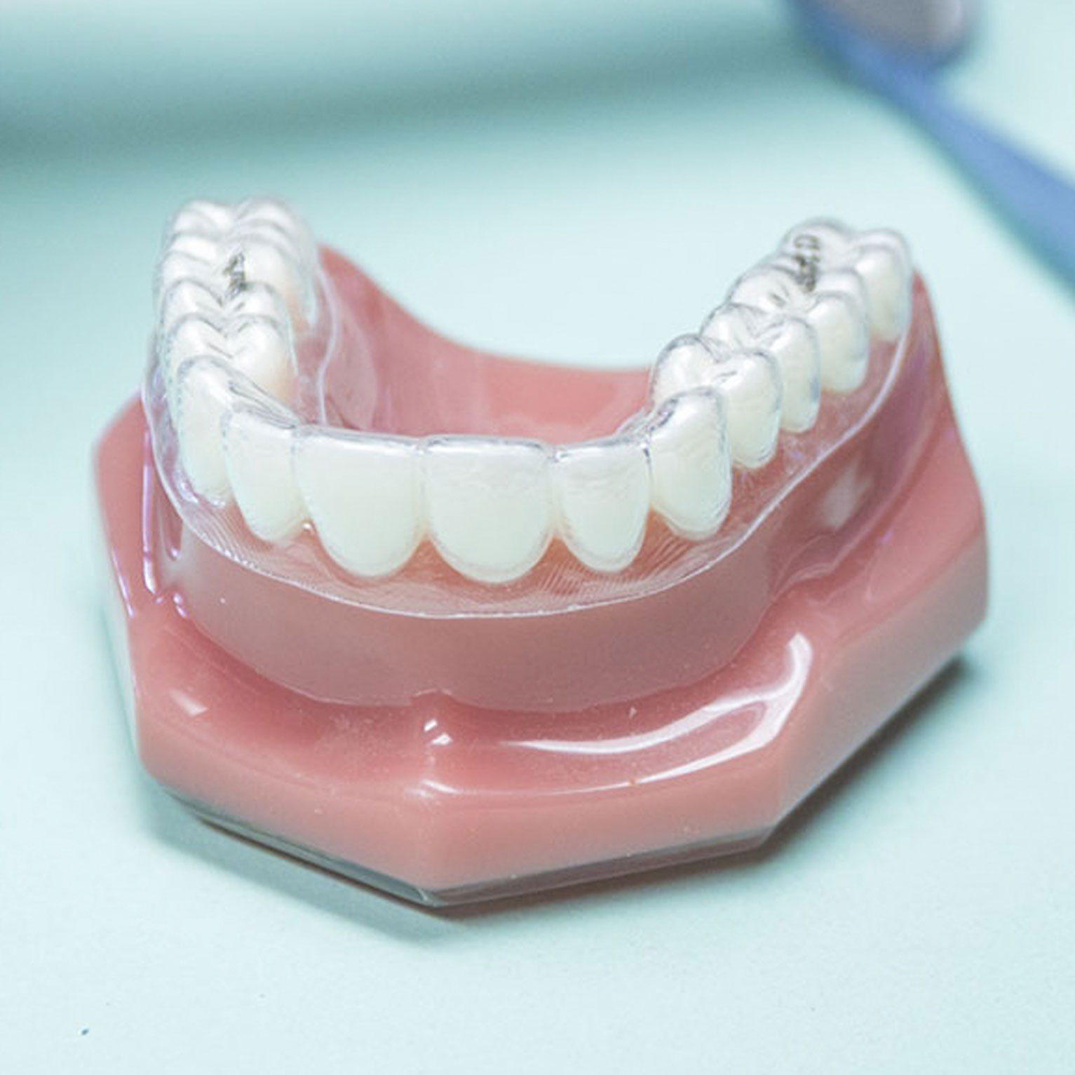 Clear dental aligner on a teeth model
